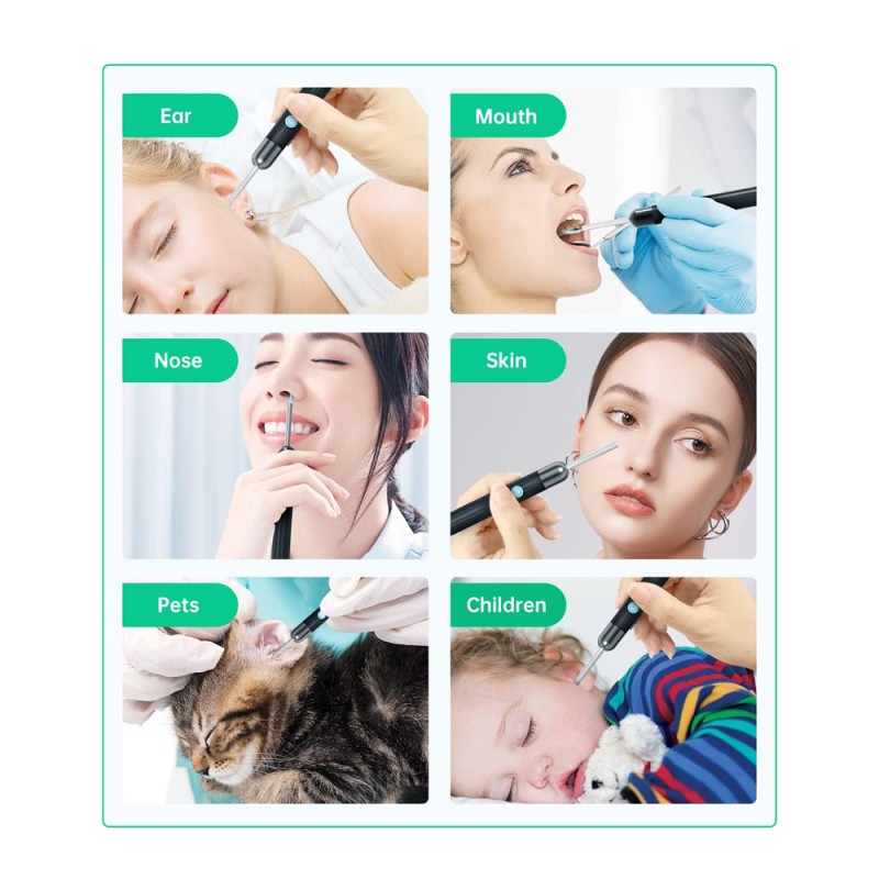 Ear Wax Removal Kit Y8 with Wi-Fi, 2MP Camera,1080P, IP67, Black